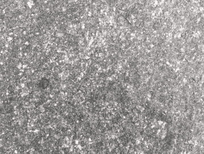 GRANITO RUSTICO MIRASEMA GRIS  20x40